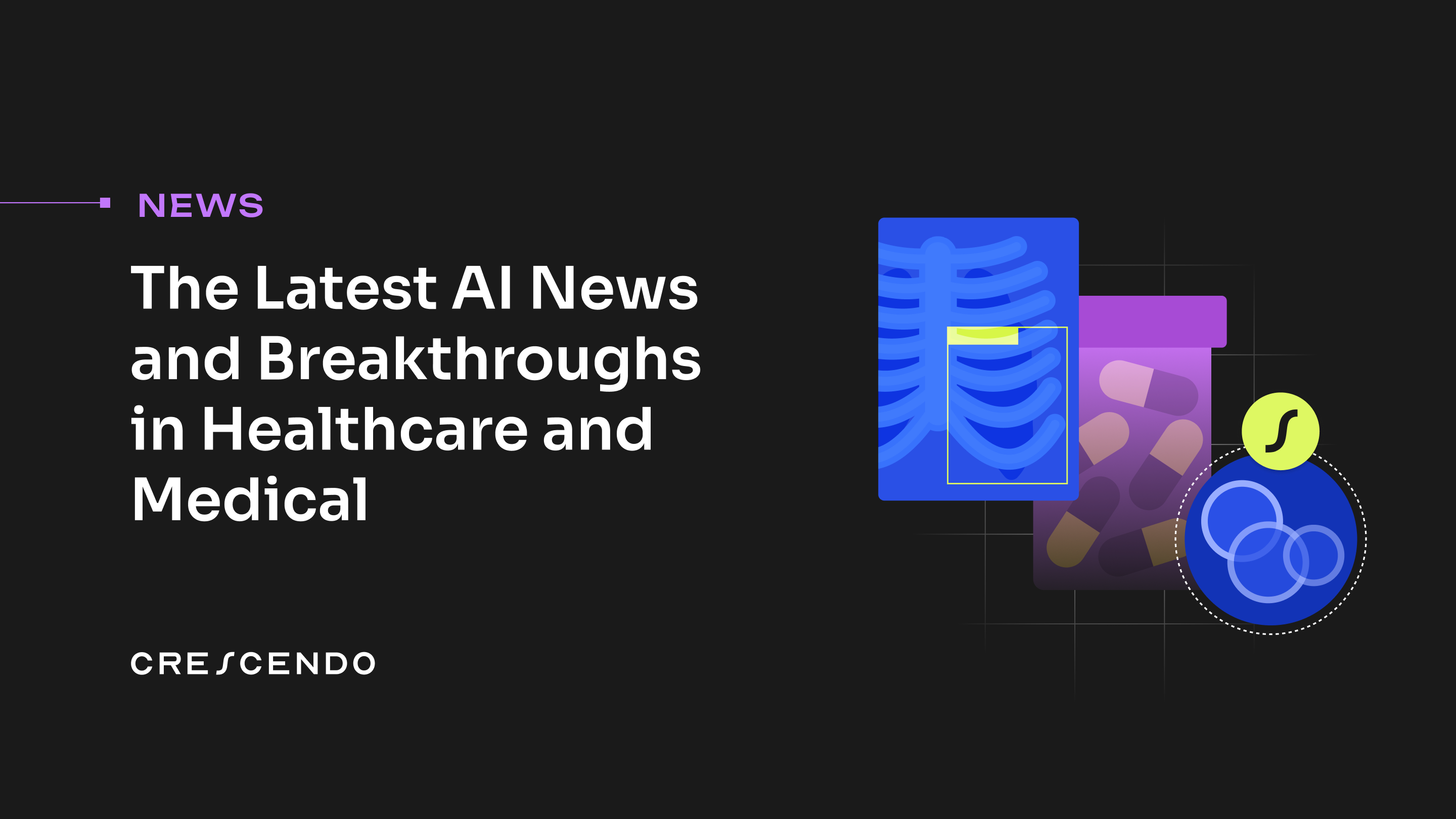 Brain MRI scan being analyzed by AI system